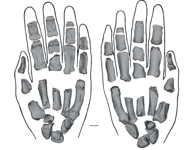 paranthropus hand bones