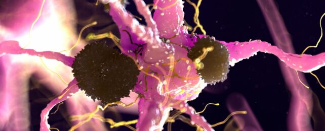 brain cells and protein clumps