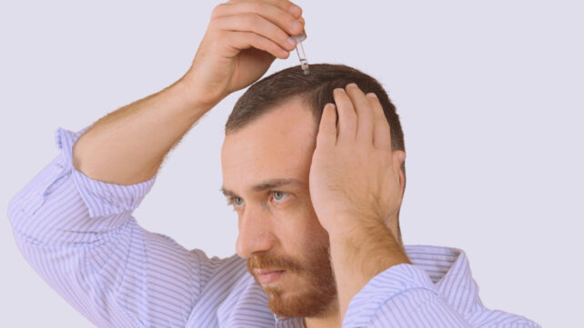 man treating hair loss