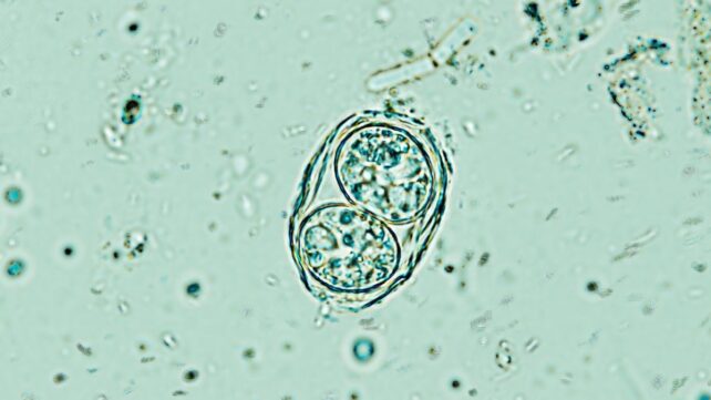 'Off Switch' Discovery Could Help Clear Our Brains of a Common Parasite