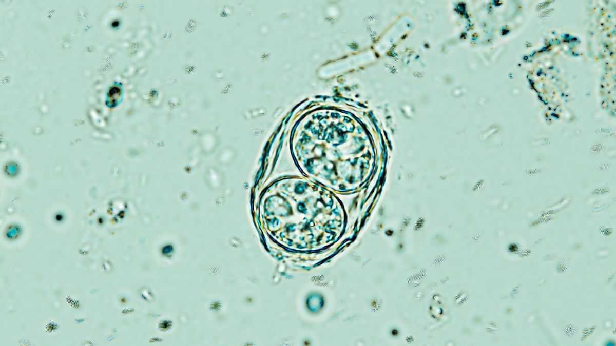 ‘Off Switch’ Discovery Could Help Clear Our Brains of a Common Parasite : ScienceAlert ‘Off Switch’ Discovery Could Help Clear Our Brains of a Common Parasite : ScienceAlert