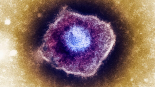 varicella virus particle