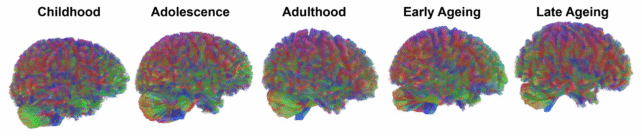 Five Epochs Brain Aging