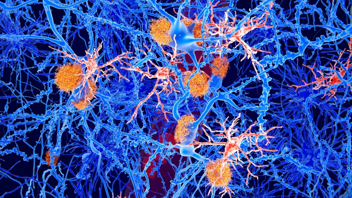‘Young’ Immune Cells Partly Reverse Alzheimer’s Symptoms in Mice : ScienceAlert