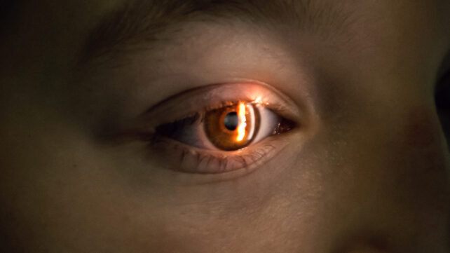 Optometrist performing visual field test
