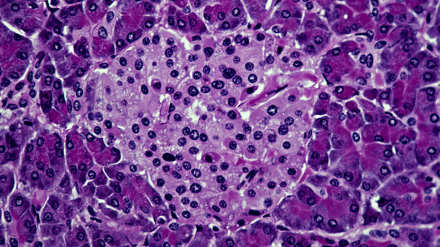 Islet cells in the pancreas