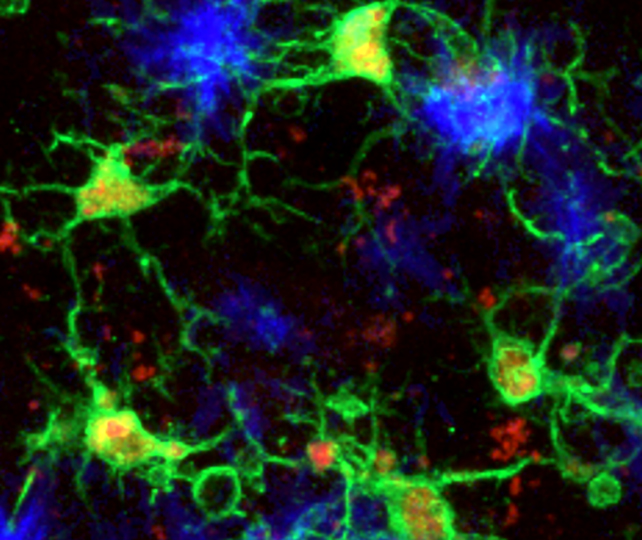 Microglia in mouse brains