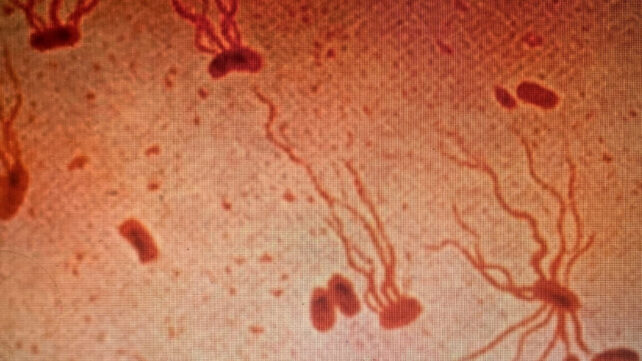 Reddish brown blobs with stringy projections, seen under a microscope
