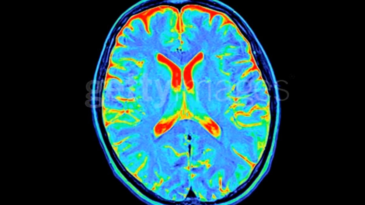 Your Brain Goes Through 5 Distinct Epochs, Massive Study Finds