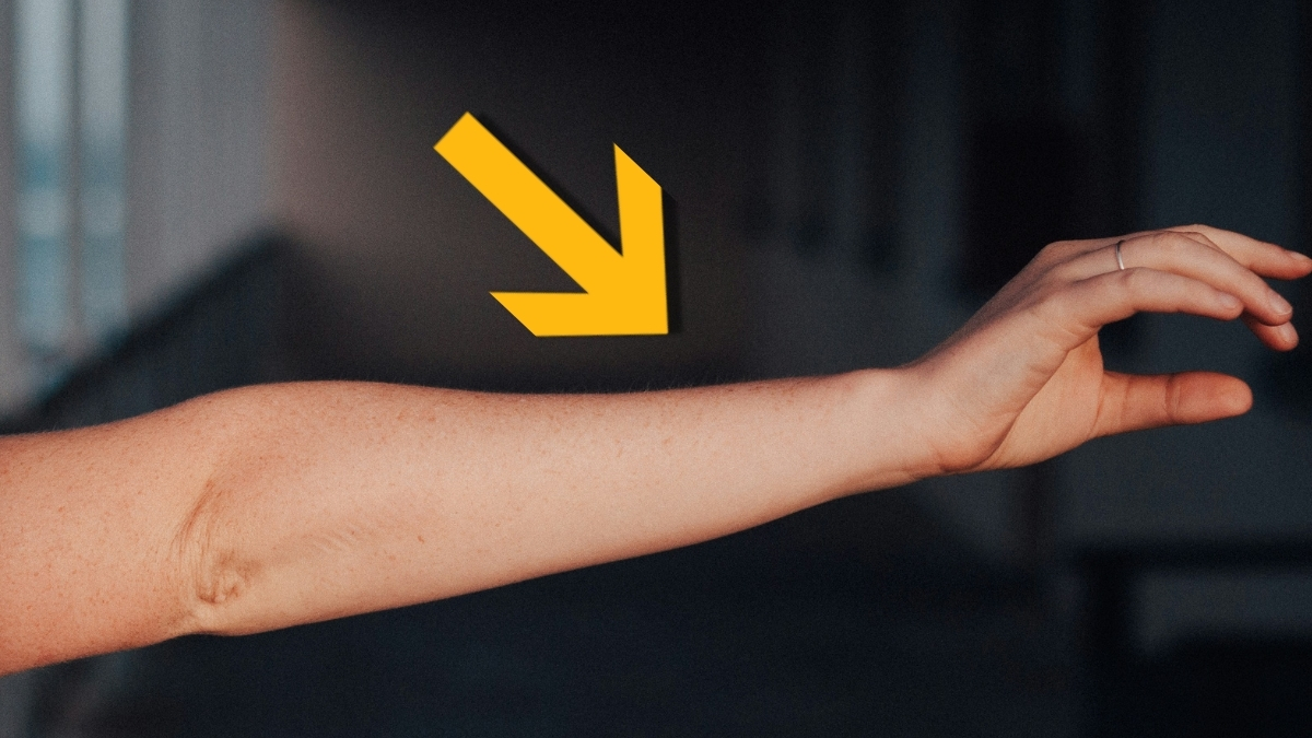 human arm with an arrow pointing at its mid section