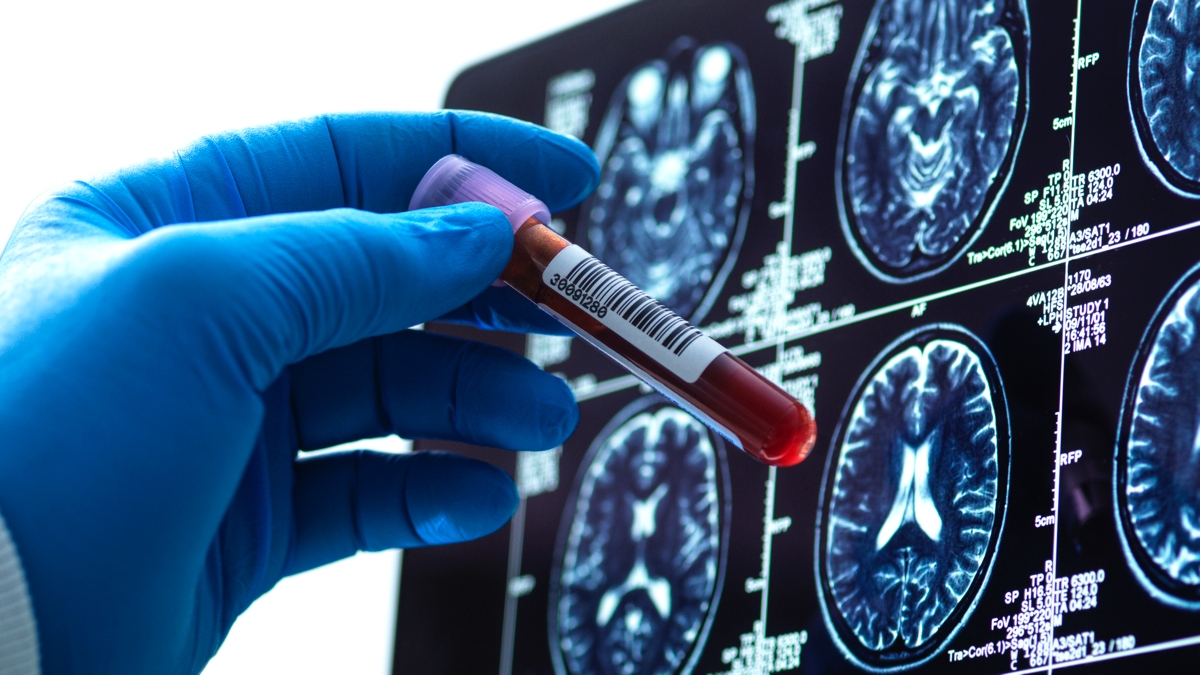 Super-Rare 'Hybrid' Blood Type Discovered in Just 3 People