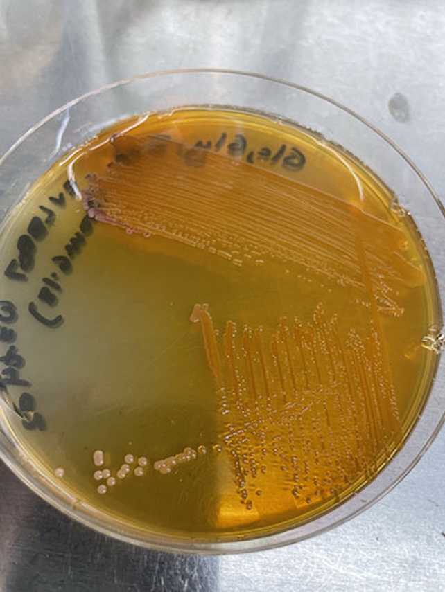 Bacteria producing xanthommatin on a petri dish in the lab.