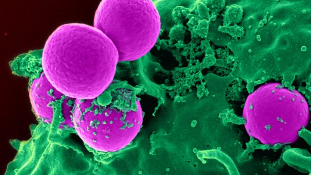 A scanning electron micrograph of a human neutrophil ingesting methicillin-resistant Staphylococcus aureus (MRSA)