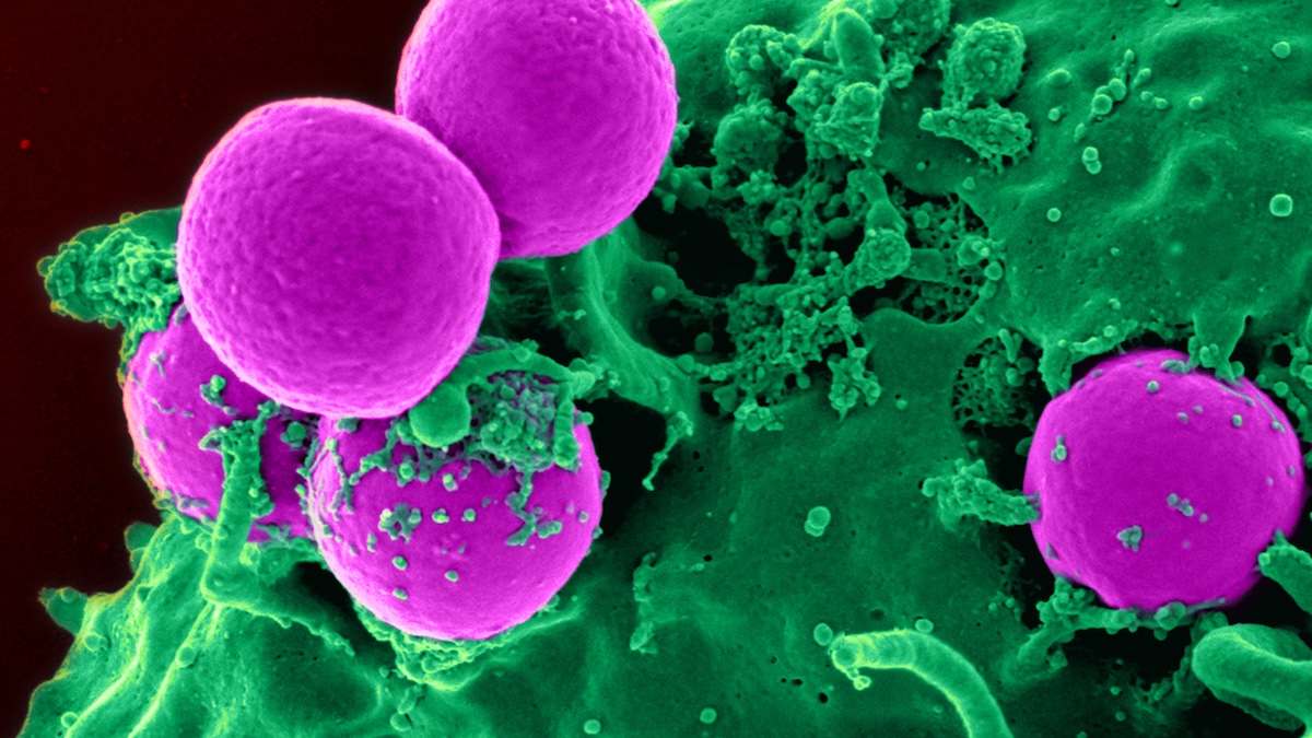 Dangerous bacteria and other disease-causing microbes are rapidly evolving ways to defy our best antibiotic medications, a phenomenon known as antimicrobial resistance.
