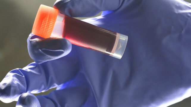 High res close up image of a gloved hand holding a vial of blood with an orange lid