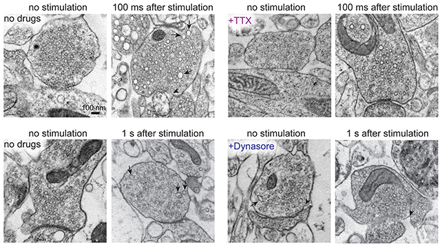 Os pesquisadores registraram a atividade celular poucos milissegundos após a estimulação. (Eddings et al., Neuron, 2025)