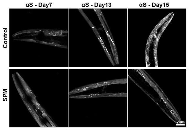 Worm spermine scans