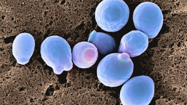 candida albicans cells, to illustrate how the common fungal infection is becoming resistant to antifungal drugs