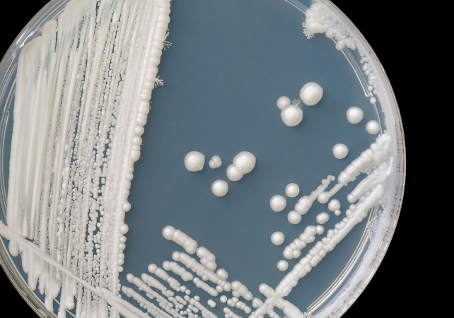 candida colonies on an agar plate