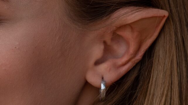 The Bizarre Biology of Elves