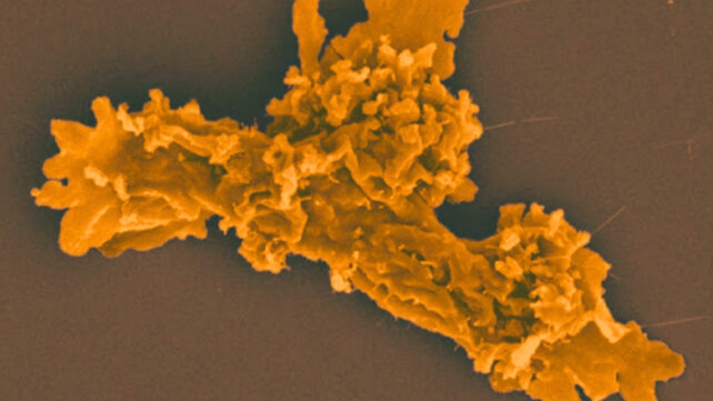 colorized amoeba image