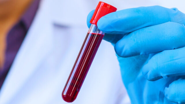 holding tube of blood