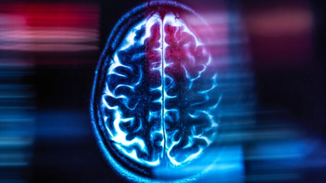 digital image of a brain