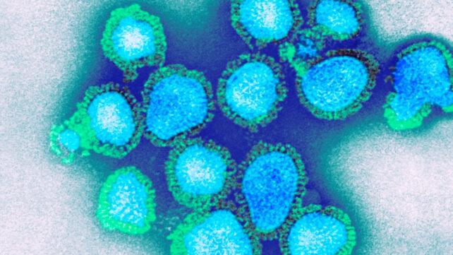 H3N1 virus particles