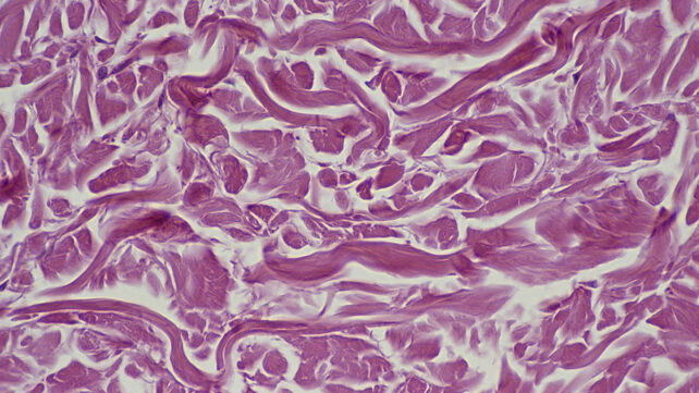 Dense fibrous connective tissue
