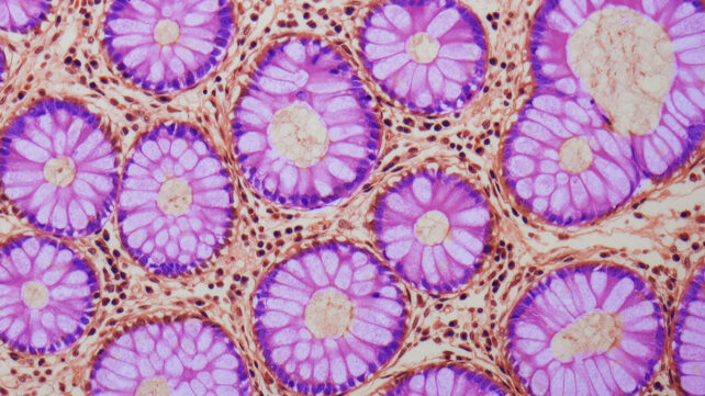 Crypts of Lieberkuhn, light micrograph