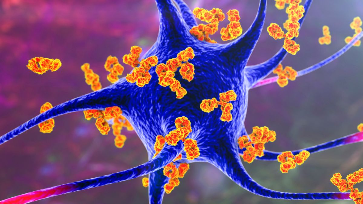 Forever Chemicals Linked to Multiple Sclerosis in Concerning New Study