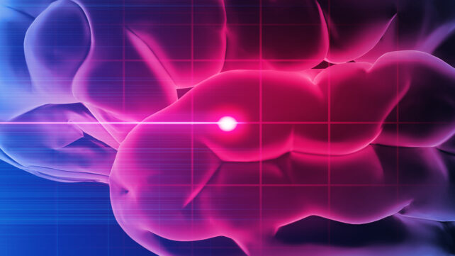 Medical 3D illustration of a man with stroke symptoms