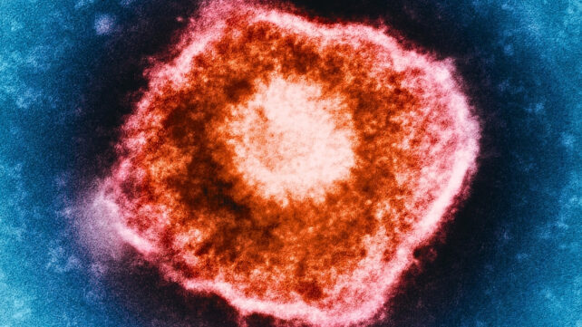 A reddish colored virus particle seen under a microscope
