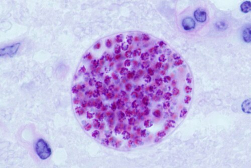 Parasite That Infects Millions T. gondii