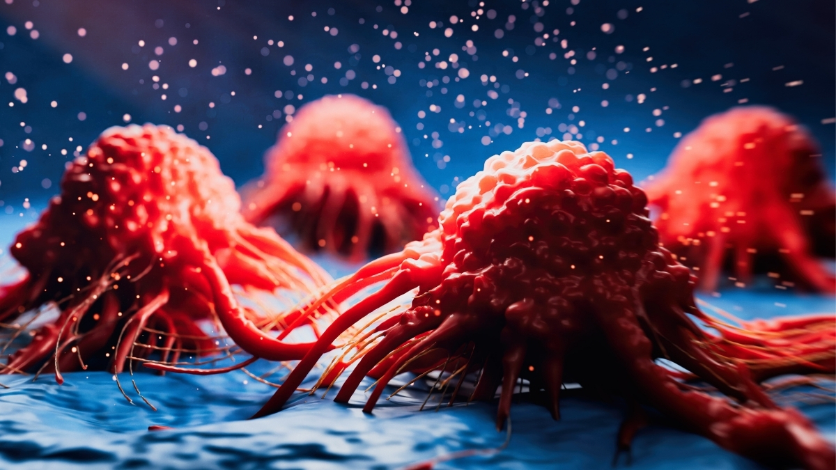 Cancer May Emit Signals That Protect The Brain Against Alzheimer's