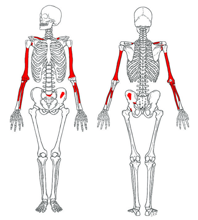 2-Million-Year-Old Homo Habilis 