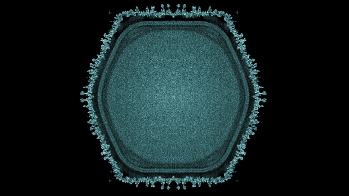 ushikuvirus electron micrograph image