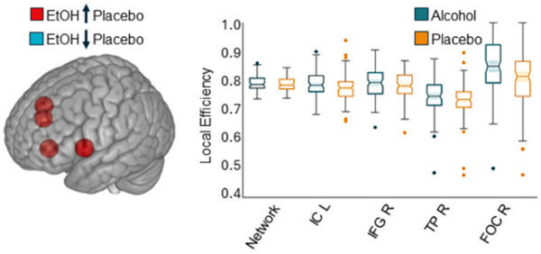 Alcohol Profoundly Changes The Way Your Brain Communicates, Study Finds ...