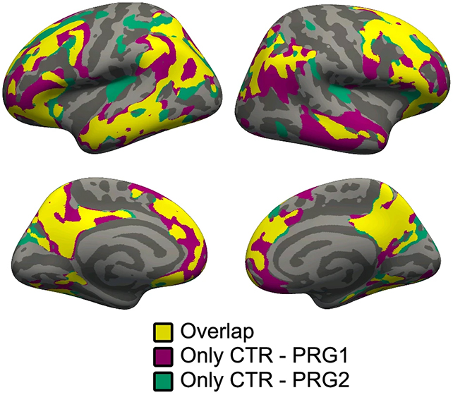 Pregnancy brain scans