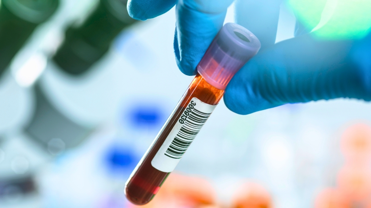 A straightforward blood test could one day reveal the earliest signs of Parkinson's disease years before more noticeable symptoms appear, according to a new study of DNA repair and cell stress.