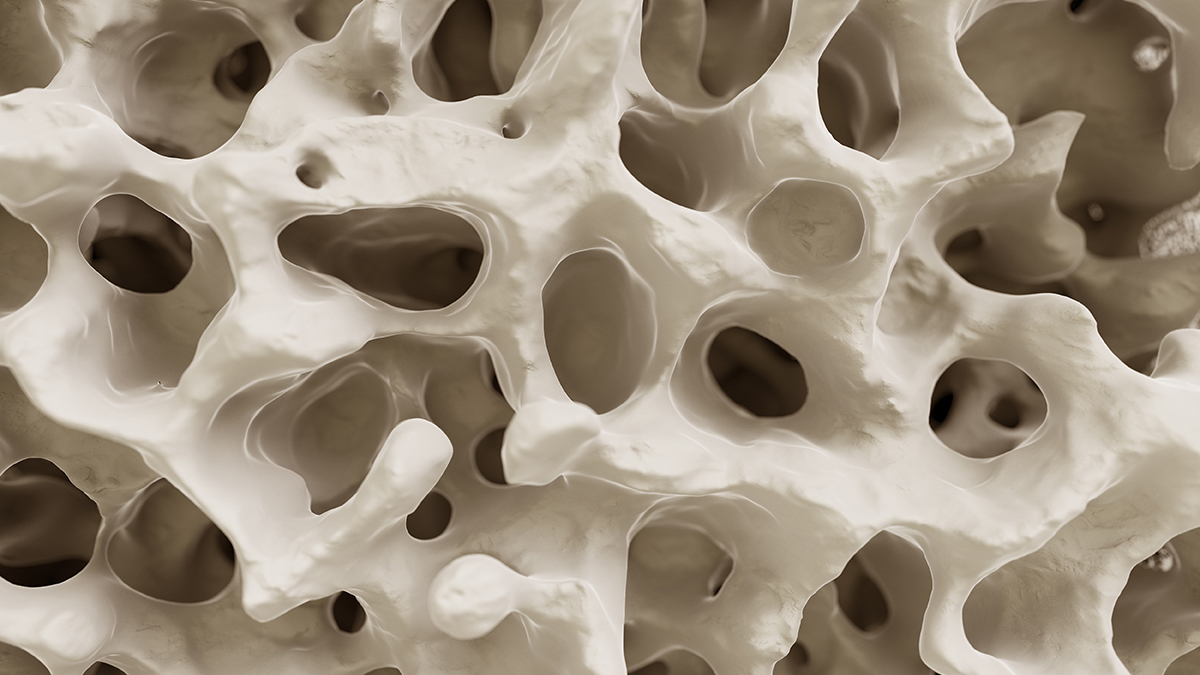 Breakthrough Study Reveals The Secret of How Exercise Fights Osteoporosis