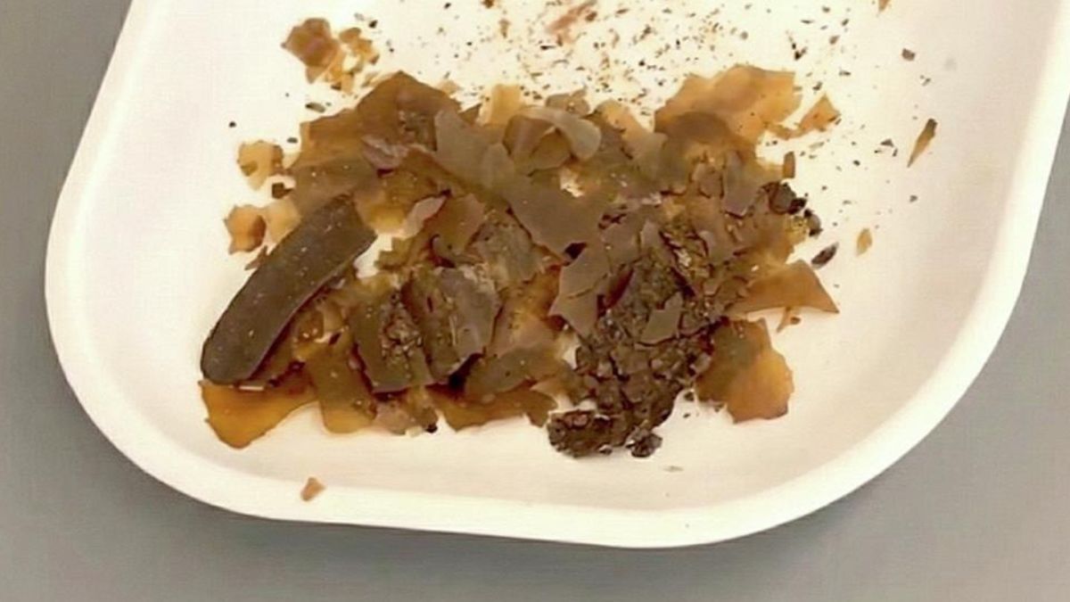 Ancient Romans Really Did Use Poop as Medicine. We Just Got The First Real Proof.