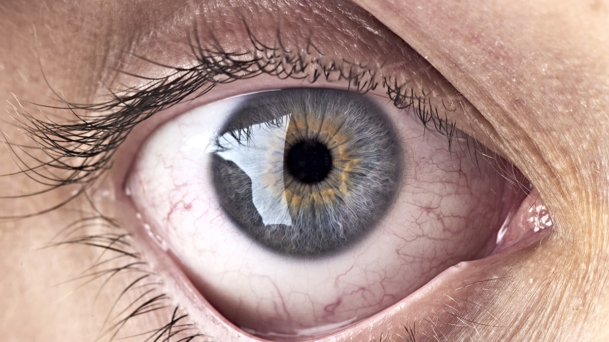 Bacteria at The Back of Your Eye May Be Linked With Alzheimer's Progress