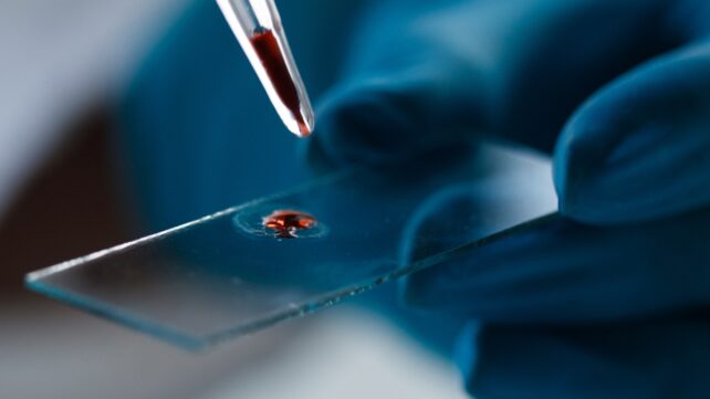 Blood Test 'Clock' Can Predict Alzheimer's Symptoms Before They Emerge