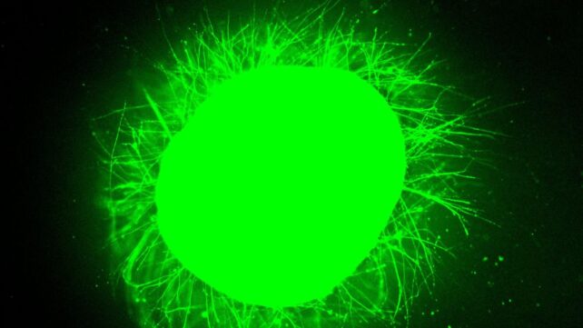 Scientists Grew Mini Human Spinal Cords, Then Made Them Repair After Injury