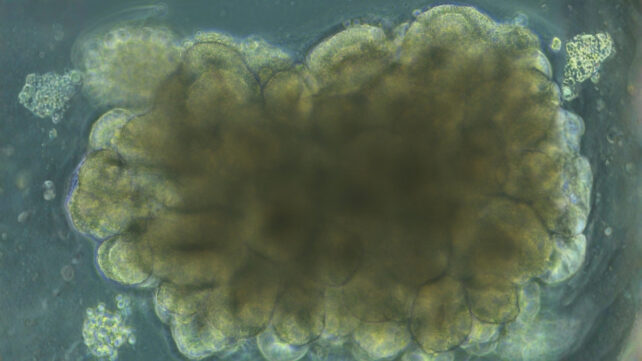 Scientists Grew Mini Brains, Then Trained Them to Solve an Engineering Problem