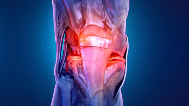 illustration of a knee glowing red to indicate pain