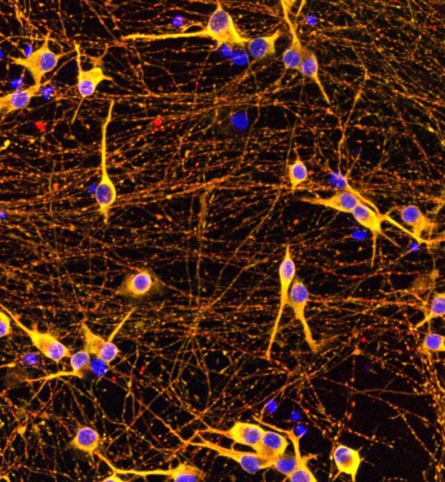 Yellow and purple cells in a matrix of reddish brown fibers