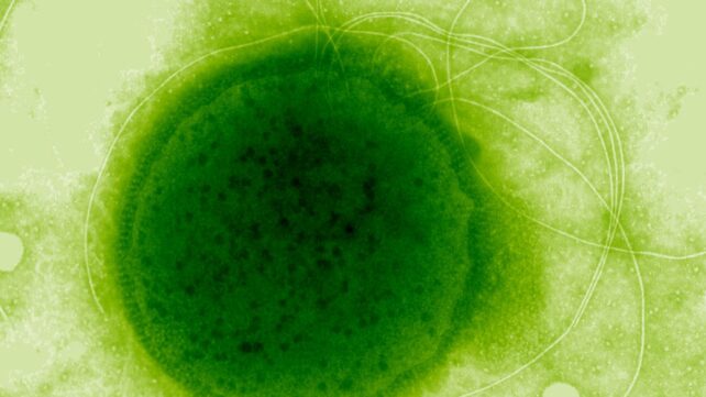 This Extreme Radiation-Resistant Organism Evolved a Remarkable Ability