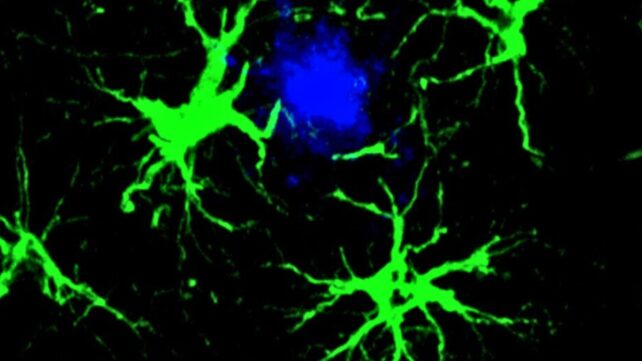 image of astrocytes targeting protein linked to Alzheimer’s disease